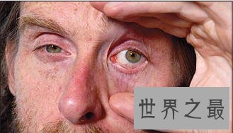 【图】人类最长工夫不睡觉纪录，整整40天(968个小时)