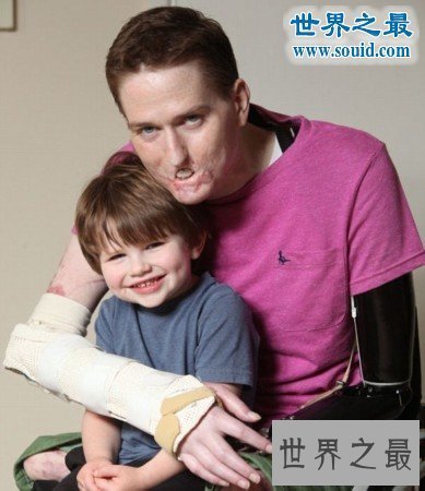 【图】世界上最恶心的人，又丑又恶心的男人女人(慎入