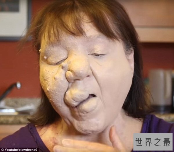 【图】世界上最恶心的人，又丑又恶心的男人女人(慎入