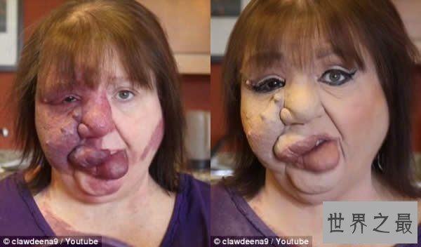 【图】世界上最恶心的人，又丑又恶心的男人女人(慎入