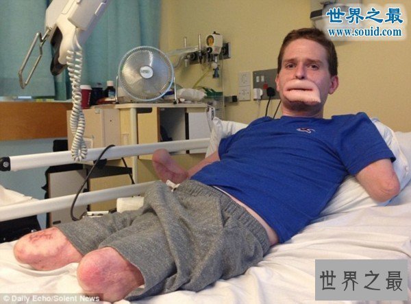 【图】世界上最恶心的人，又丑又恶心的男人女人(慎入