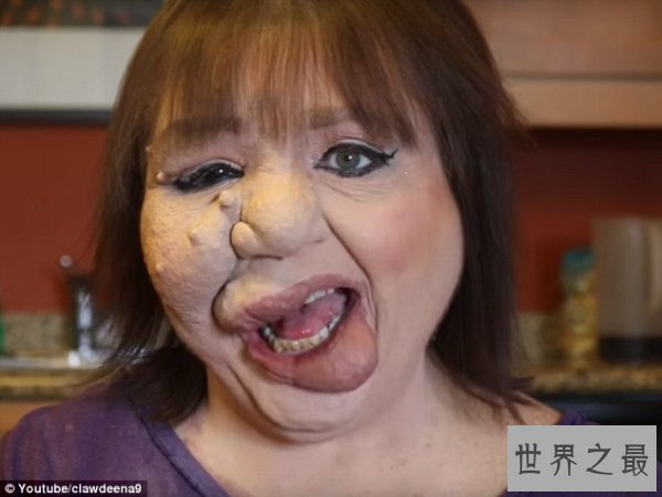 【图】世界上最恶心的人，又丑又恶心的男人女人(慎入