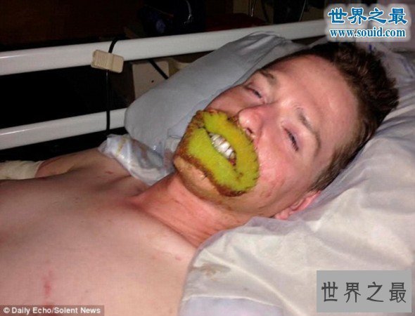 【图】世界上最恶心的人，又丑又恶心的男人女人(慎入