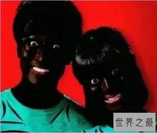 【图】世界上最黑的孩子，黑出了新高度(连眼珠都是黑