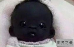 【图】世界上最黑的孩子，黑出了新高度(连眼珠都是黑
