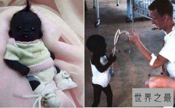 【图】世界上最黑的孩子，黑出了新高度(连眼珠都是黑