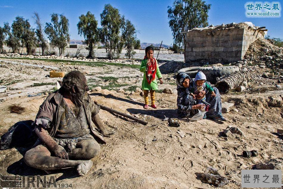 【图】人类最长工夫不洗澡纪录，伊朗男子60年不洗澡