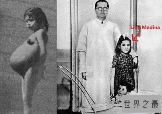 【图】清点世界最小母亲，琳娜·玛迪纳5岁就当妈