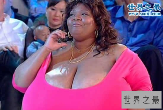【图】世界上最大的自然乳房，双乳重达77斤(图)