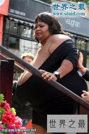 【图】世界上最大的自然乳房，双乳重达77斤(图)