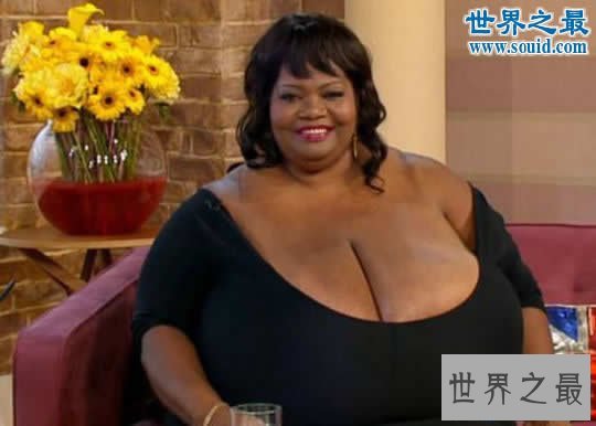 【图】世界上最大的自然乳房，双乳重达77斤(图)
