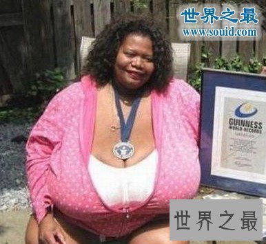 【图】世界上最大的自然乳房，双乳重达77斤(图)
