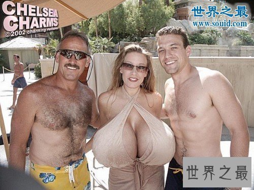 【图】世界上最大的自然乳房，双乳重达77斤(图)