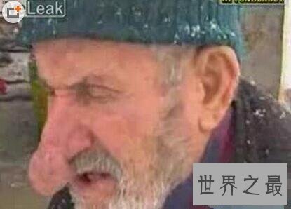 【图】世界上最大肺活量的人，曼吉特·辛格吹出2.44米