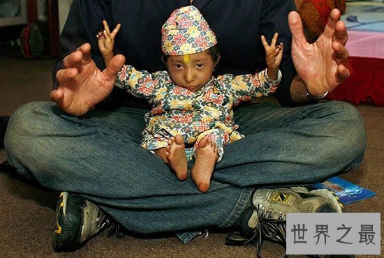 【图】世界上最小的人只要9斤重，清点十大奇葩袖珍小