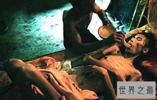 世界上最早被发现的艾滋病 从美国发现的瘟疫之源