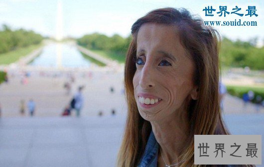 【图】世界上最俊俏的女人，世界上20个最丑的人(怕吐