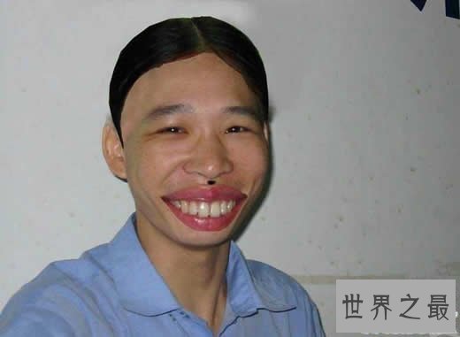 【图】世界上最俊俏的女人，世界上20个最丑的人(怕吐