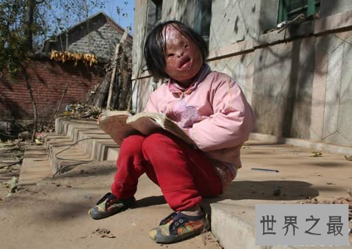 【图】世界上最俊俏的女人，世界上20个最丑的人(怕吐