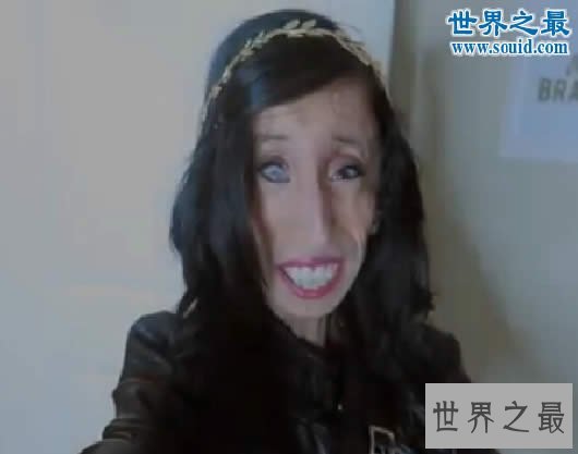 【图】世界上最俊俏的女人，世界上20个最丑的人(怕吐