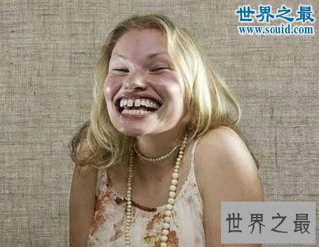 【图】世界上最俊俏的女人，世界上20个最丑的人(怕吐