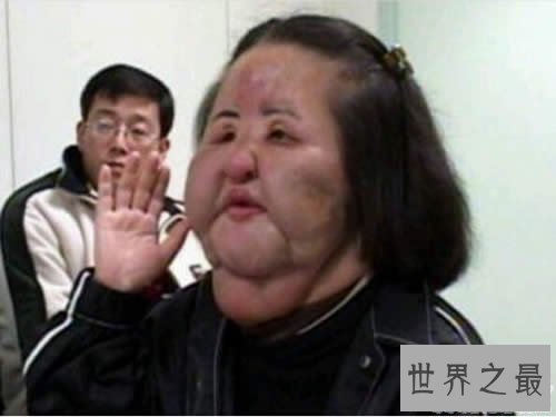 【图】世界上最俊俏的女人，世界上20个最丑的人(怕吐