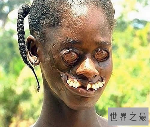 【图】世界上最俊俏的女人，世界上20个最丑的人(怕吐