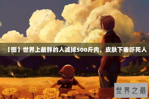 【图】世界上最胖的人减掉500斤肉，皮肤下垂吓死人