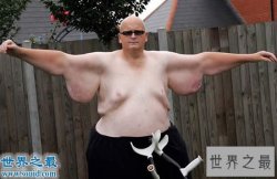 【图】世界上最胖的人减掉500斤肉，皮肤下垂吓死人
