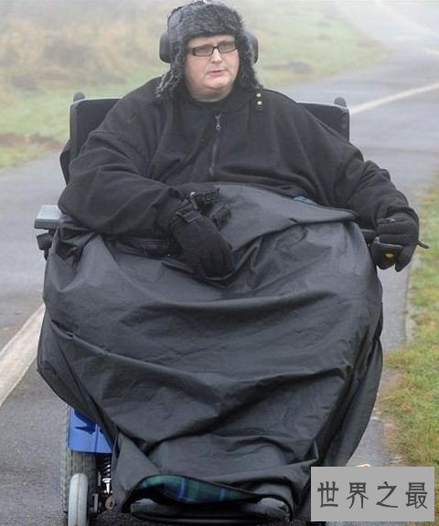 【图】世界上最胖的人减掉500斤肉，皮肤下垂吓死人