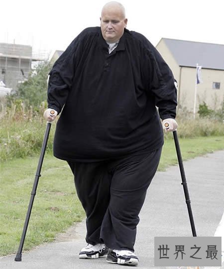 【图】世界上最胖的人减掉500斤肉，皮肤下垂吓死人