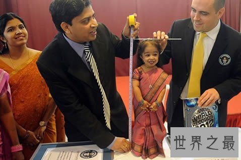 【图】世界上体重最轻的人，18岁少年体重仅11斤(图)