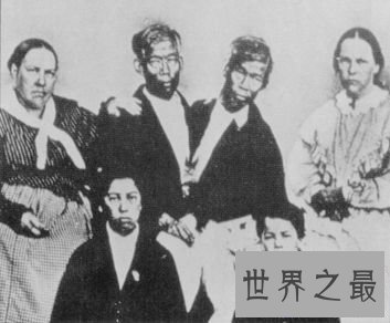 【图】世界上最著名的连体人，在泰国竖起雕像成为美