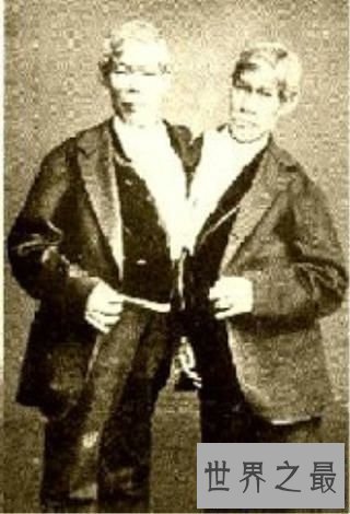 【图】世界上最著名的连体人，在泰国竖起雕像成为美