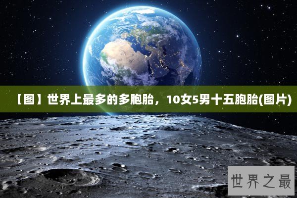 【图】世界上最多的多胞胎，10女5男十五胞胎(图片)