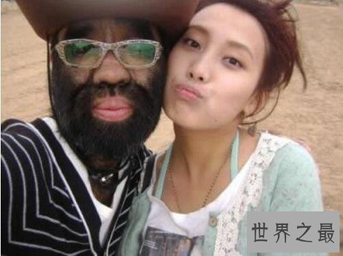 【图】中国第一毛孩于震寰，全身毛发照旧找到了真爱