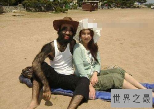 【图】中国第一毛孩于震寰，全身毛发照旧找到了真爱