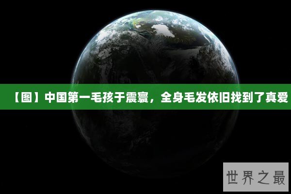 【图】中国第一毛孩于震寰，全身毛发依旧找到了真爱