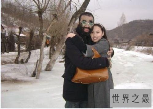 【图】中国第一毛孩于震寰，全身毛发照旧找到了真爱