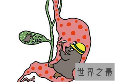 【图】你得胆汁反流性胃炎了吗？最佳治疗方法通知你