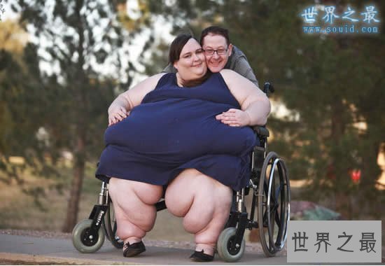 【图】世界第一胖人，苏珊娜.埃曼重达1450斤(图片)