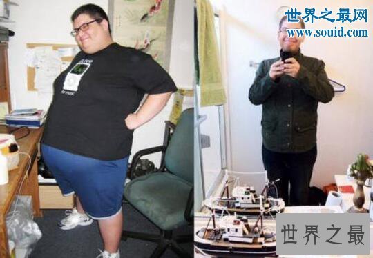 【图】世界上最长工夫不吃饭的人，禁食382天减肥