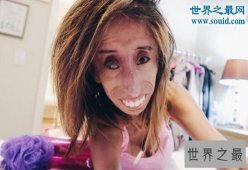 【图】世界上最丑的女人，被恶毒诅咒快去死(励志逆袭