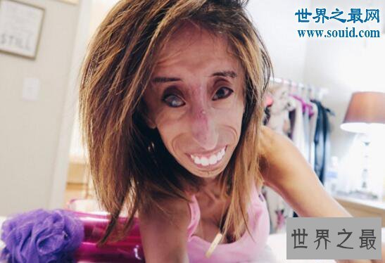 【图】世界上最丑的女人，被恶毒谩骂快去死(励志逆袭