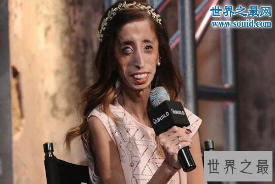 【图】世界上最丑的女人，被恶毒谩骂快去死(励志逆袭