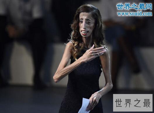 【图】世界上最丑的女人，被恶毒谩骂快去死(励志逆袭