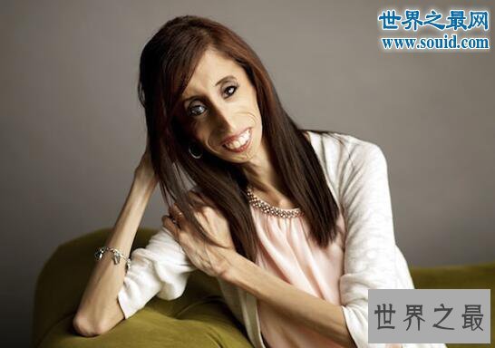 【图】世界上最丑的女人，被恶毒谩骂快去死(励志逆袭