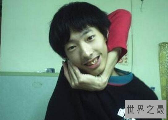 【图】世界六大奇怪橡胶人，美国蛇女可能将身材无限