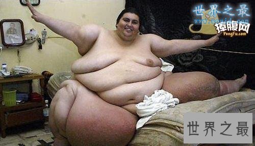 【图】世界上最胖的男人曼努埃尔·乌里韦，重达1194斤