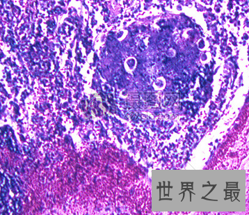【图】妻子赌气喝下毒药 到底有多大的毒性致人死亡